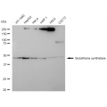 KD-Validated GSS Rabbit mAb (20 μl)