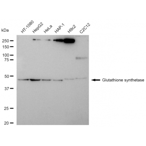 LifeSab™ KD-Validated GSS Rabbit mAb (20 μl)