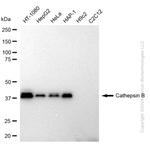 KD-Validated CTSB Rabbit mAb (20 μl)