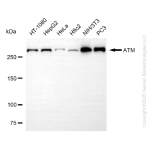 KO Validated ATM Rabbit mAb (20 μl)