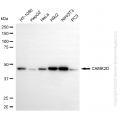 KO Validated CAMK2D Rabbit mAb (20 μl)
