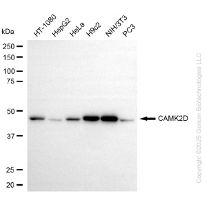 KO Validated CAMK2D Rabbit mAb (20 μl)