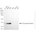 KO Validated CDK6 Rabbit mAb (20 μl)