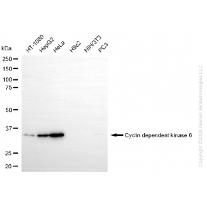 KO Validated CDK6 Rabbit mAb (20 μl)