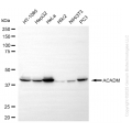 KO Validated ACADM Rabbit mAb (20 μl)