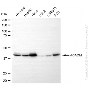 KO Validated ACADM Rabbit mAb (20 μl)