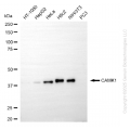 KO Validated CAMK1 Rabbit mAb (20 μl)
