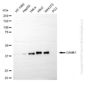 KO Validated CAMK1 Rabbit mAb (20 μl)