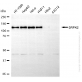 KO-Validated SRPK2 Mouse mAb (20 μl)