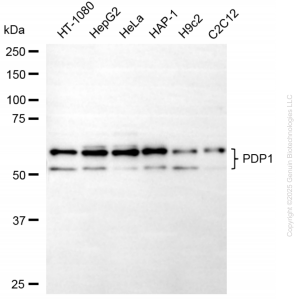 KO-Validated PDP1 Mouse Oligoclonal Antibody (20 μl)