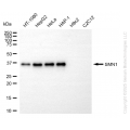 KO-Validated SMN1 Rabbit mAb (20 μl)