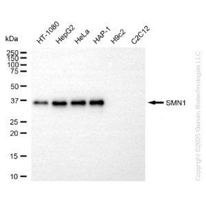KO-Validated SMN1 Rabbit mAb (20 μl)