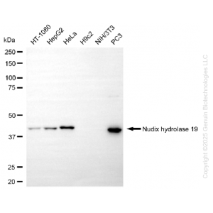 KO-Validated NUDT19 Rabbit mAb (20 μl)