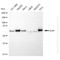 KO-Validated ELK1 Rabbit mAb (20 μl)