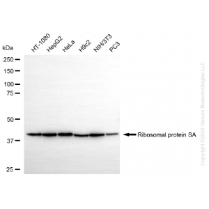 KO-Validated RPSA Rabbit mAb (20 μl)