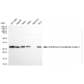 KO-Validated GSTO1 Rabbit mAb (20 μl)