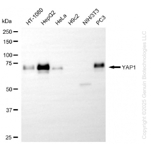 KO-Validated YAP1 Rabbit mAb (20 μl)