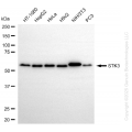 KO-Validated STK3 Rabbit mAb (20 μl)