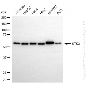 KO-Validated STK3 Rabbit mAb (20 μl)