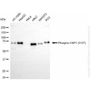 KO-Validated Phospho-YAP1 (S127) Rabbit mAb (20 μl)
