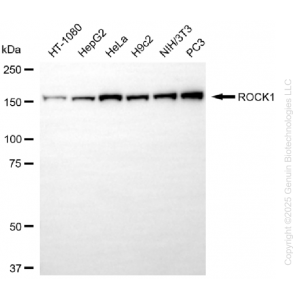 KO-Validated ROCK1 Rabbit mAb (20 μl)