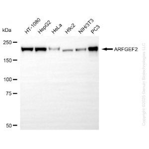 KO-Validated ARFGEF2 Rabbit mAb (20 μl)