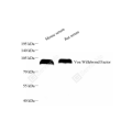 Anti-Von Willebrand Factor Rabbit pAb (100 μl)