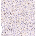 Anti-ADGRE1 Rabbit pAb (100 μl)