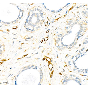 Anti-Vimentin Rabbit pAb (100 μl)