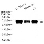 Anti-Tyrosine Hydroxylase Rabbit pAb (100 μl)