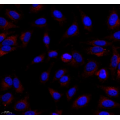 Anti-SQSTM1/p62 Rabbit pAb (100 μl)