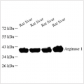 Anti-Arginase 1 Rabbit pAb (100 μl)