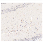 Anti-ADGRE1 Rabbit pAb (100 μl)