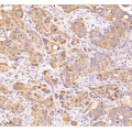 Anti-SQSTM1 / p62 Rabbit pAb (100 μl)