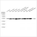Anti-beta III Tubulin Mouse mAb (100 μl)