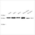 Anti-Bcl-2 Mouse mAb (100 μl)
