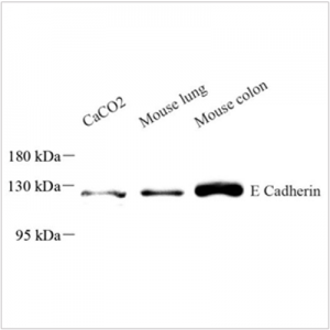 Anti-E Cadherin Mouse mAb (100 μl)