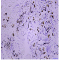 Anti-ACP5 Mouse mAb (50 μl)
