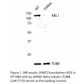 ABL1 Polyclonal Antibody (20 μl)