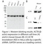 ACTB Polyclonal Antibody (20 μl)