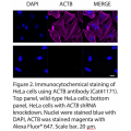 ACTB Polyclonal Antibody (20 μl)