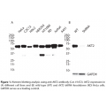 AKT2 Polyclonal Antibody (20 μl)