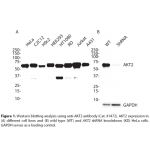 AKT2 Polyclonal Antibody (20 μl)