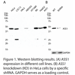 ASS1 Polyclonal Antibody (20 μl)