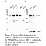 ATG16L1 Polyclonal Antibody (20 μl)