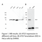 ATG7 Polyclonal Antibody (20 μl)