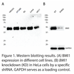BMI1 Polyclonal Antibody (20 μl)