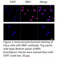 BMI1 Polyclonal Antibody (20 μl)