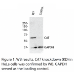 CAT Polyclonal Antibody (20 μl)