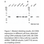 CDK4 Polyclonal Antibody (20 μl)